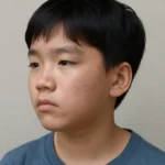 초등학생 좁쌀 여드름