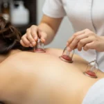 부항의 효능과 주의사항