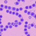 스트렙토카르푸스 삭소롬